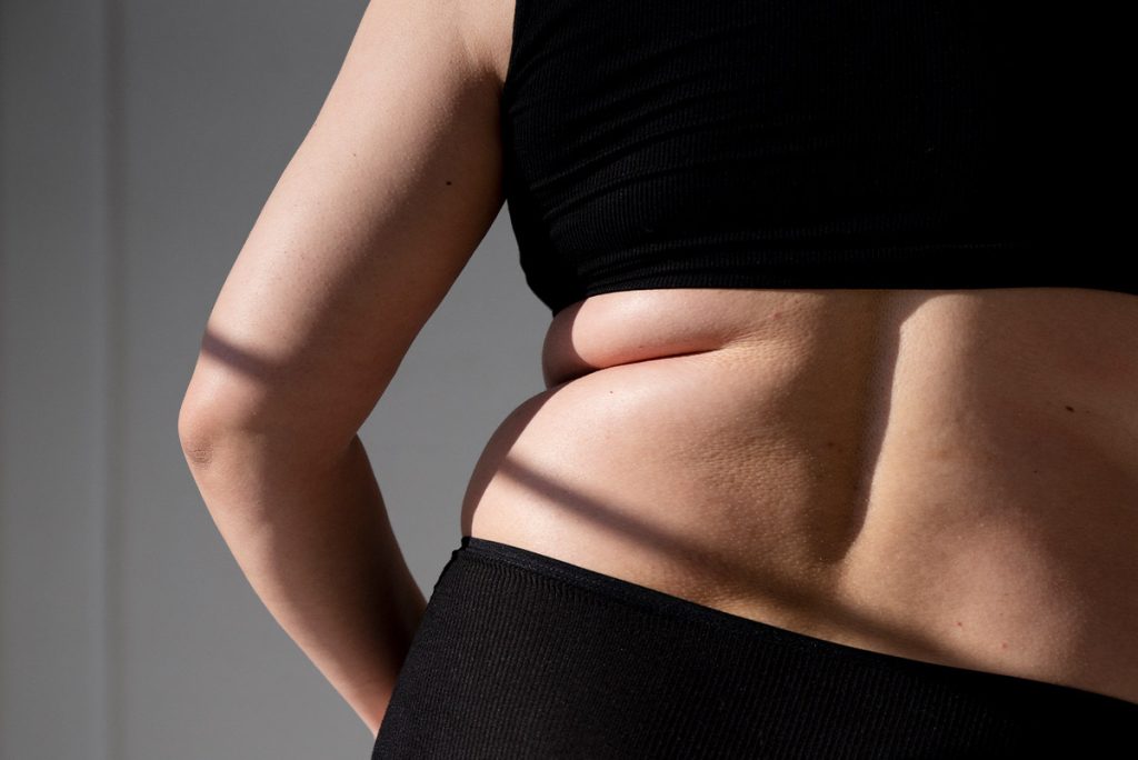 Full Guide on Vaser Liposuction in Turkey