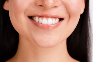 Affordable Porcelain Dental Veneers in Turkey | Full Guide 