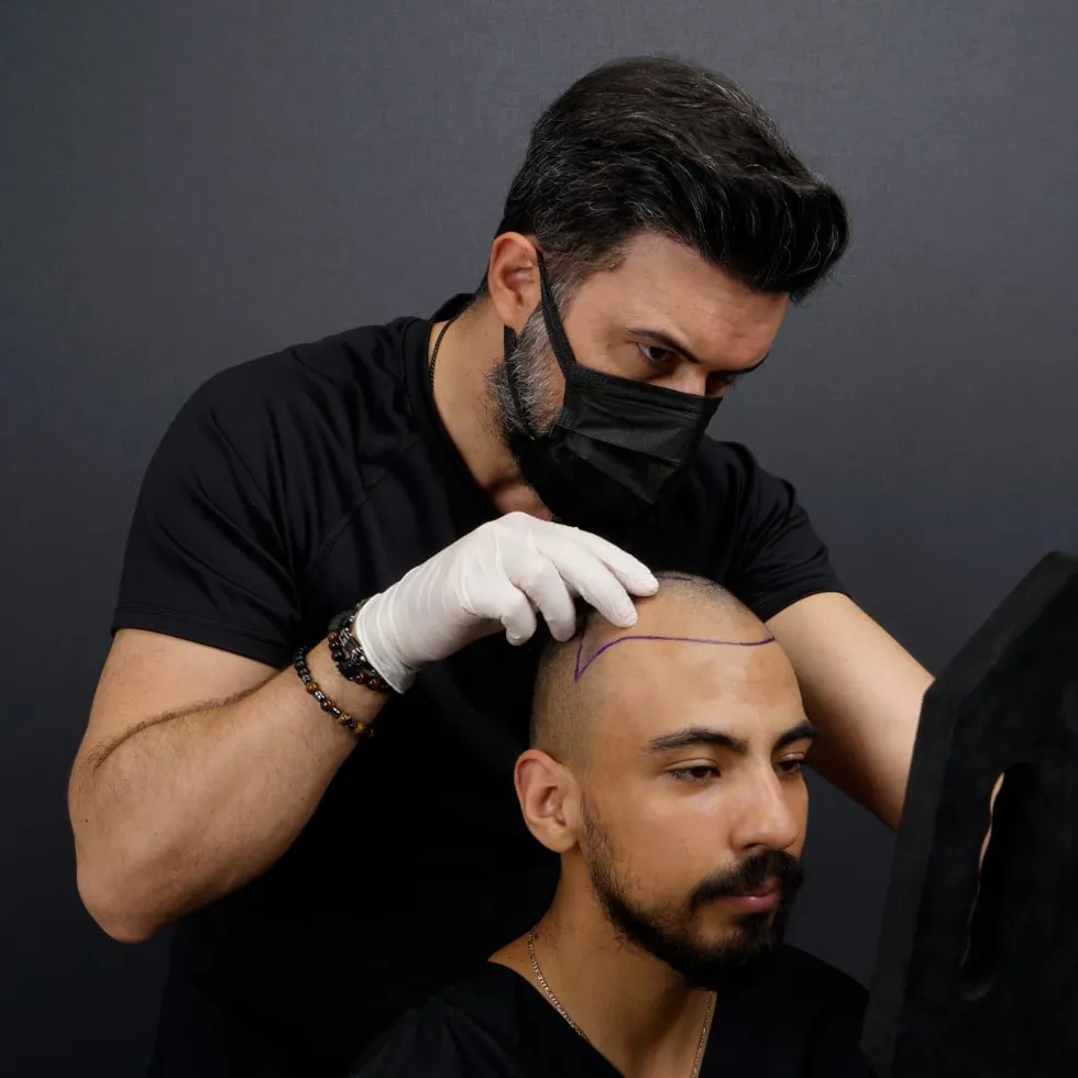 Hair transplant quality